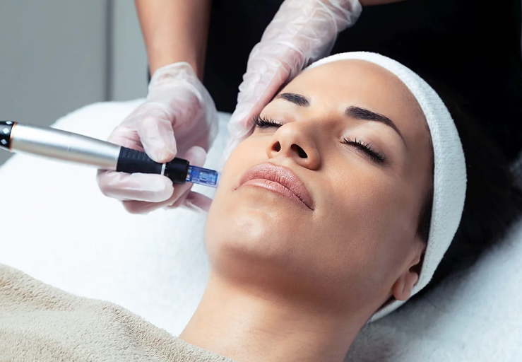 Tratamientos faciales avanzados — Dermapen